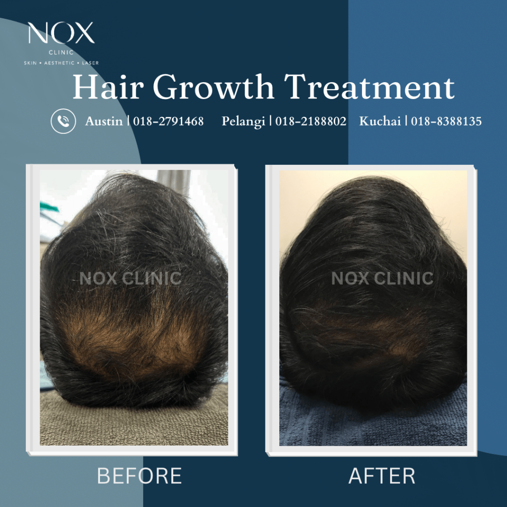 Exosome Hair 2
